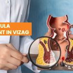 Anal Fistula Treatment in Vizag