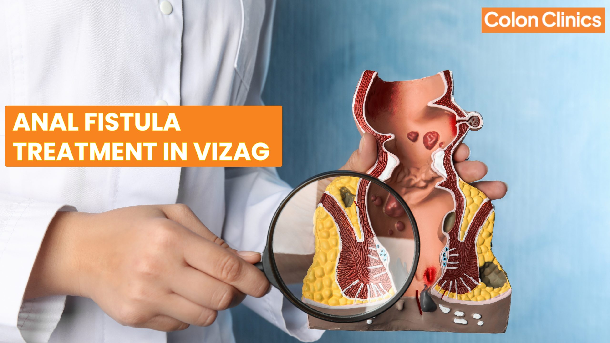 Anal Fistula Treatment in Vizag
