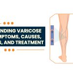 Best Varicose Veins Treatment in Vizag