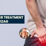 Piles Laser Treatment Cost in Vizag – Colon Clinics