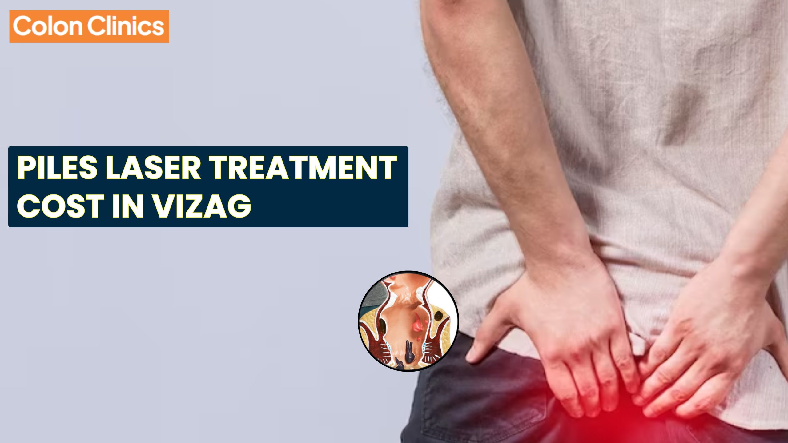 Piles Laser Treatment Cost in Vizag – Colon Clinics