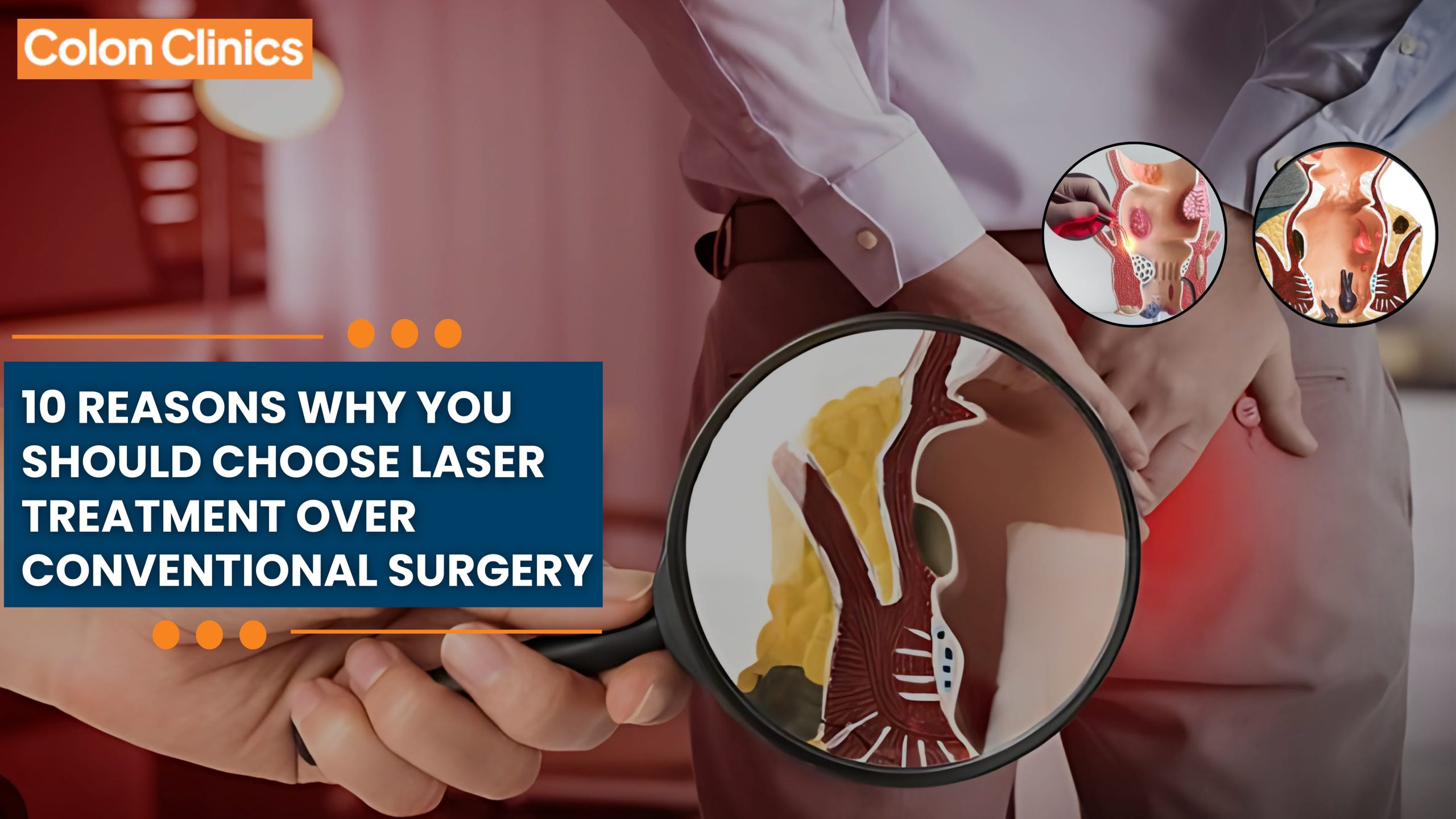 laser treatment for piles in Vizag