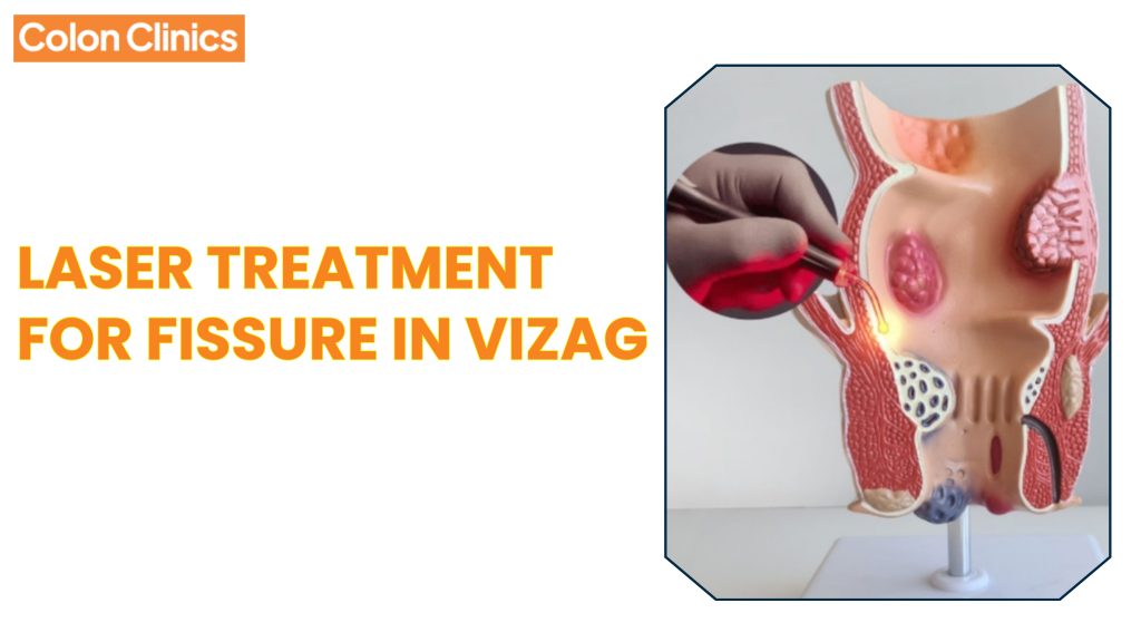 Laser Treatment for Fissure in Vizag