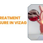 Laser Treatment for Fissure in Vizag