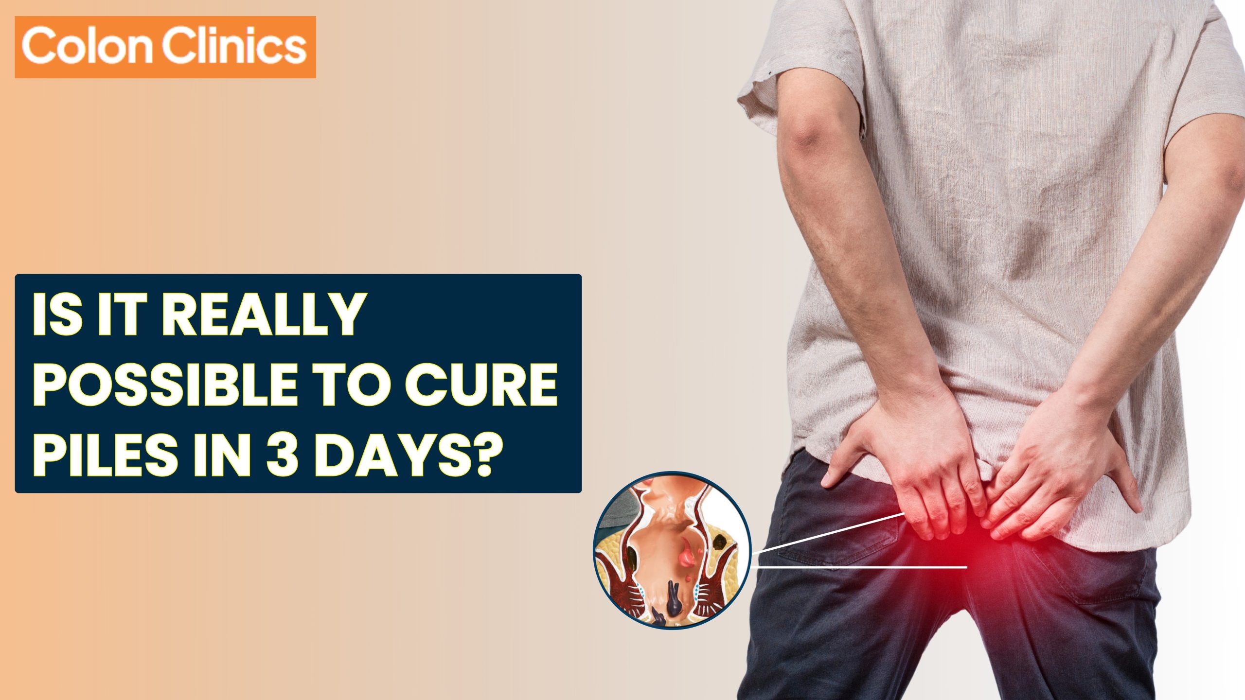 piles treatment in Vizag