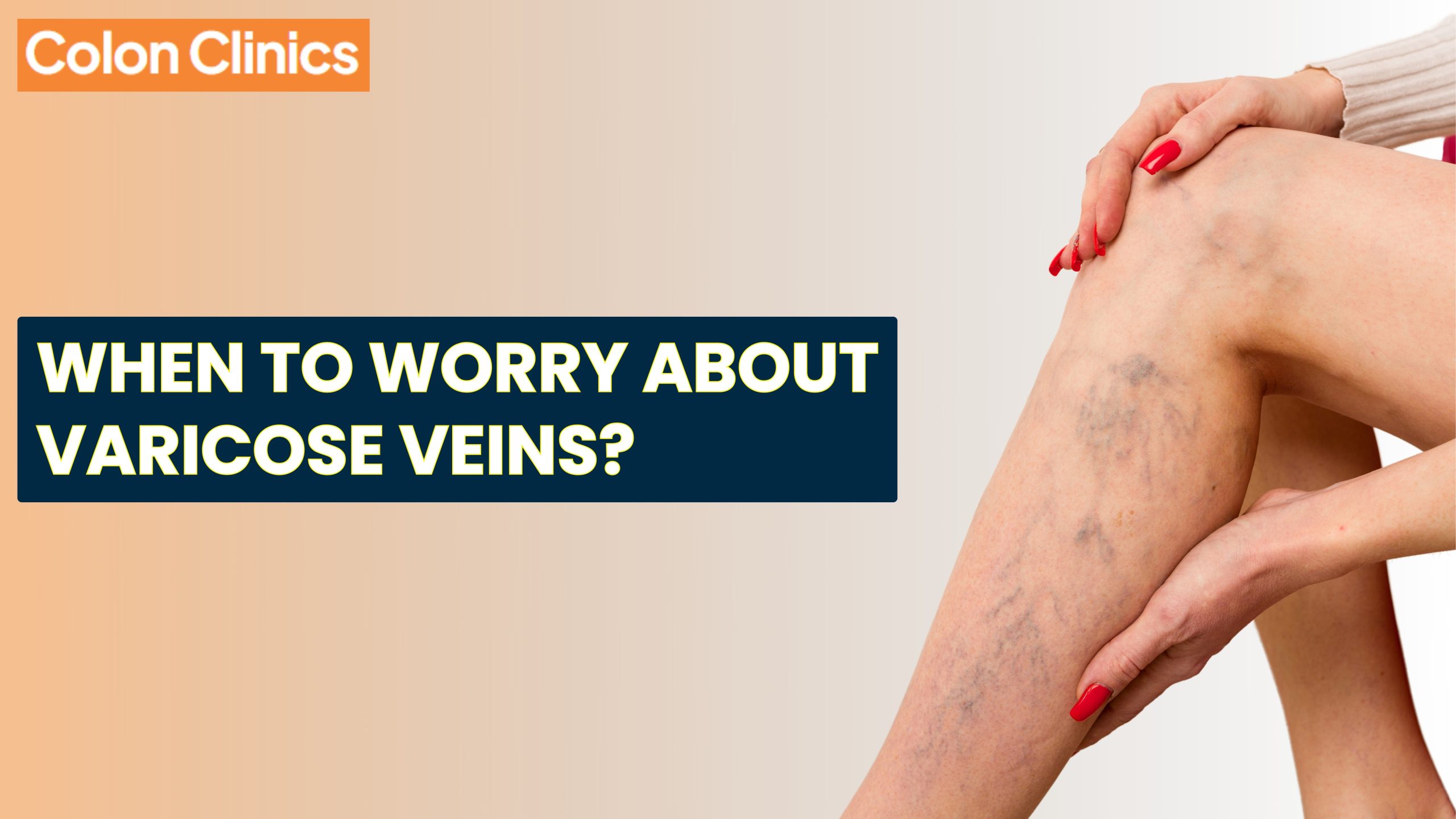 varicose veins treatment in Vizag