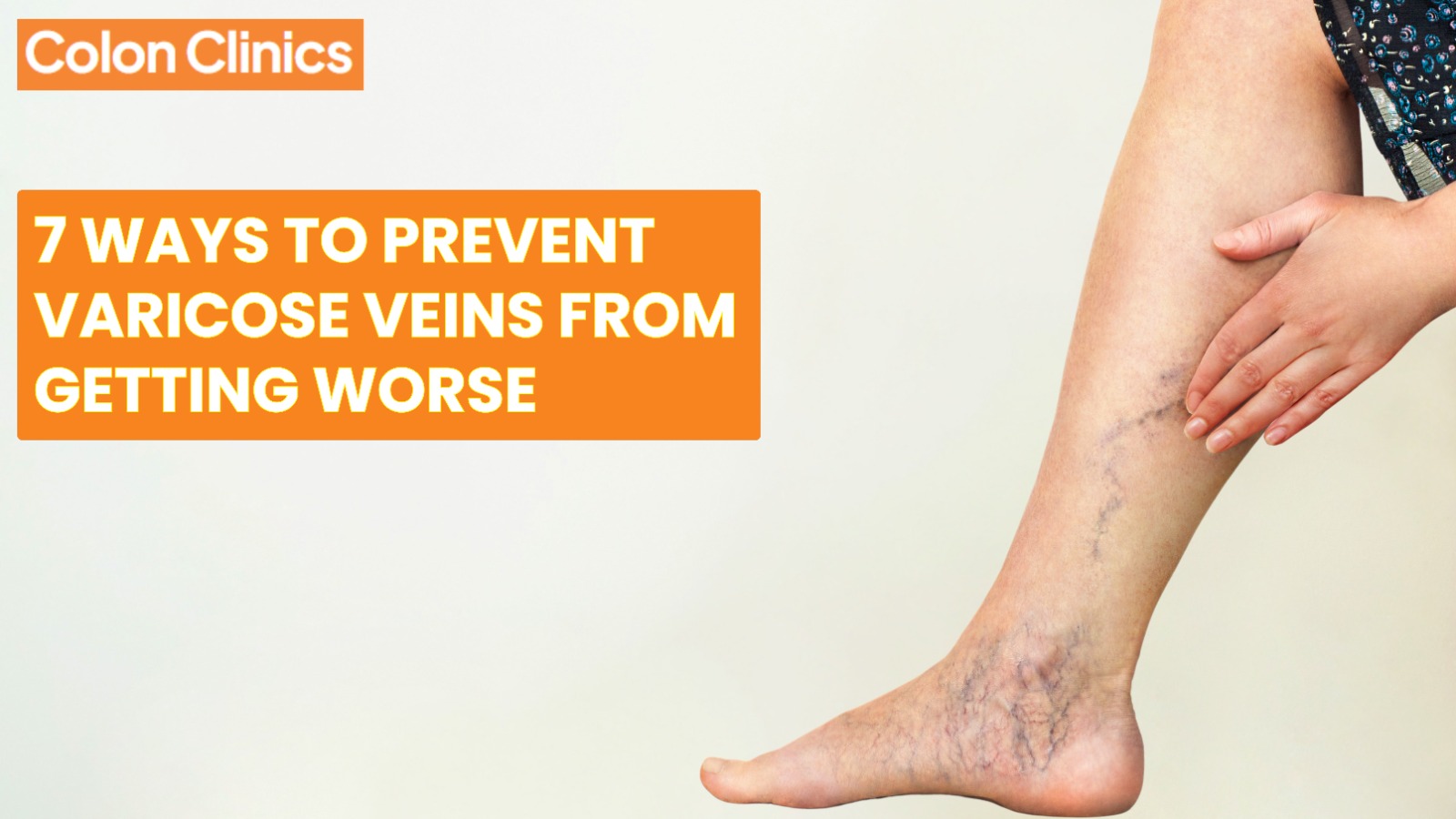 Varicose Veins Treatment in Vizag