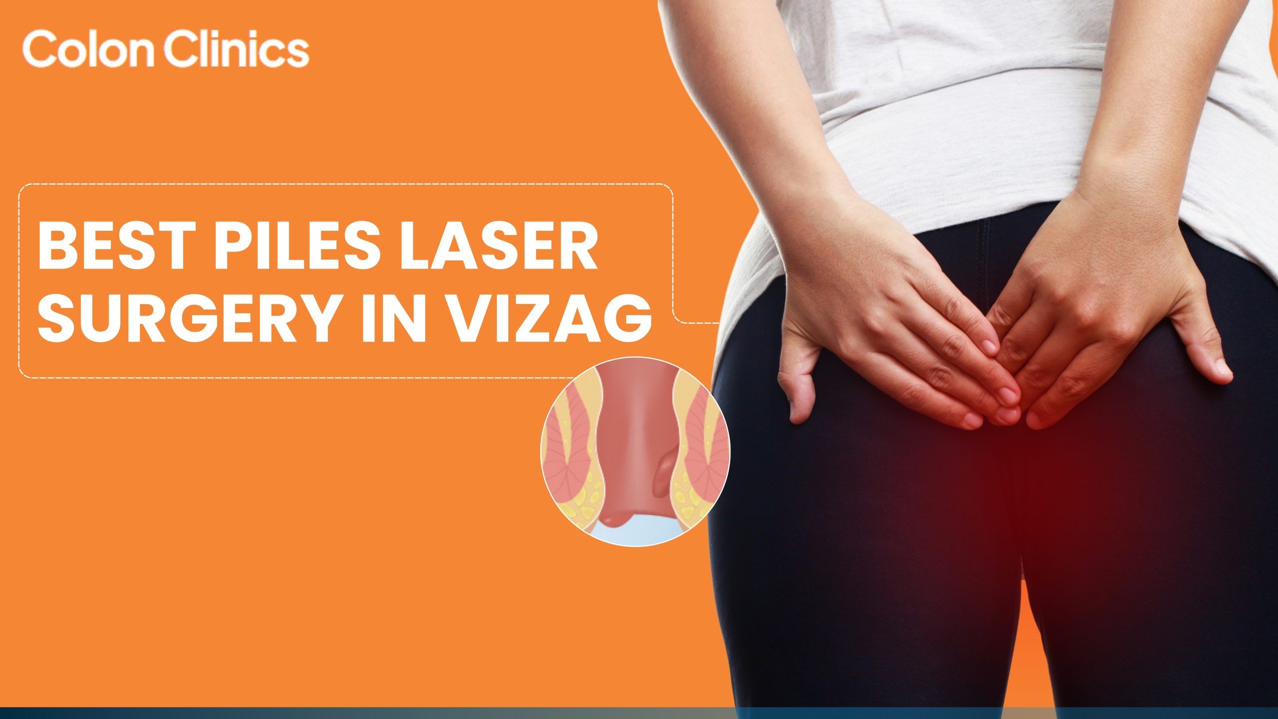 Best Piles Laser Surgery in Vizag