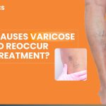varicose vein treatment in Vizag