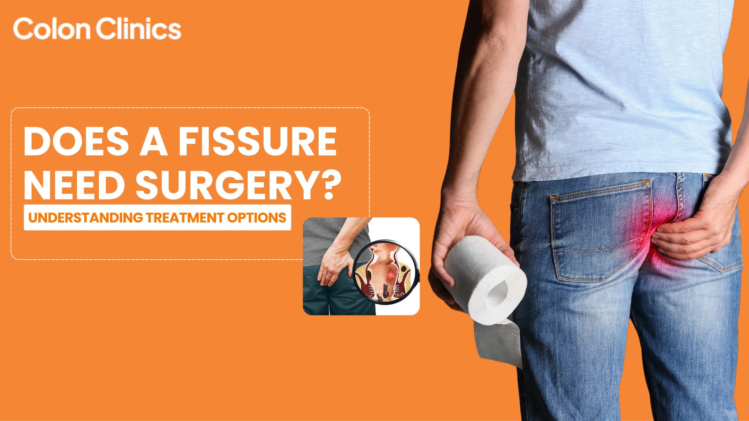 Anal Fissure Surgery in Vizag