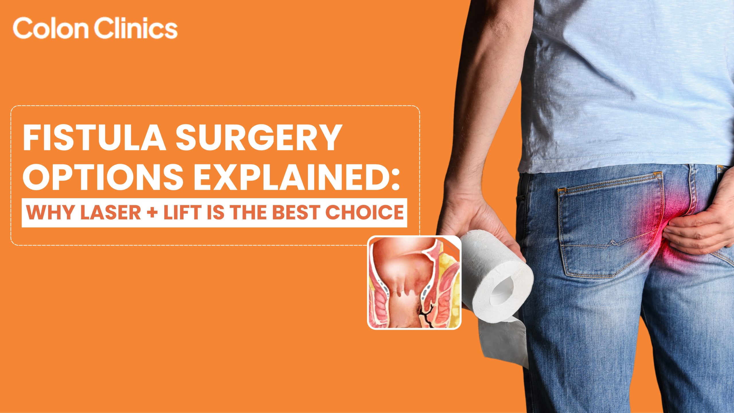 Fistula Surgery in Visakhapatnam