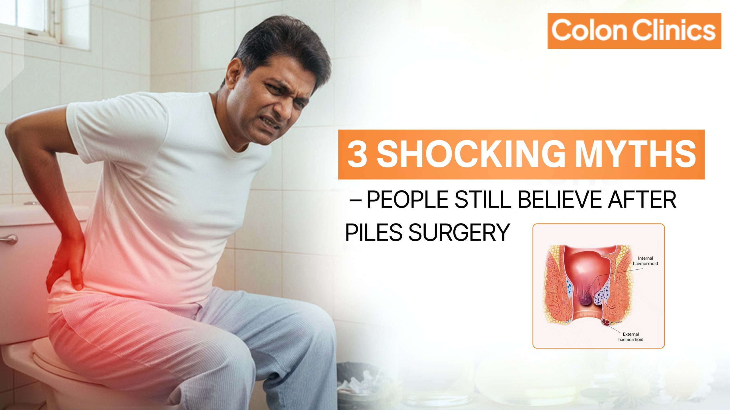 piles surgery in Vizag