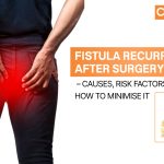 Fistula Recurrence After Surgery