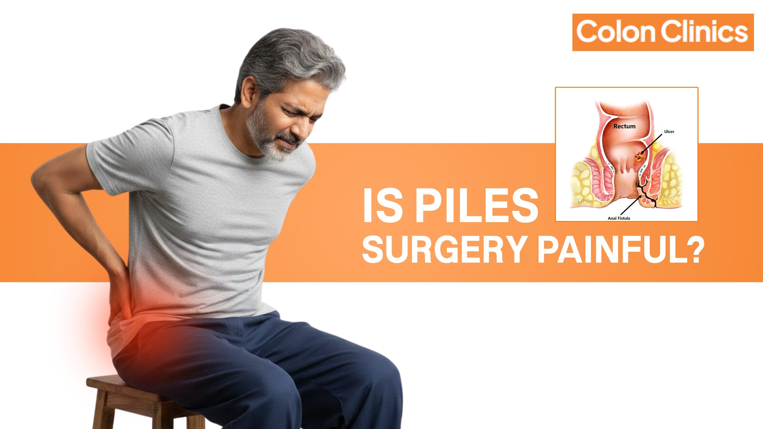 laser pile treatment in Vizag