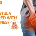 fistula treatment in Vizag