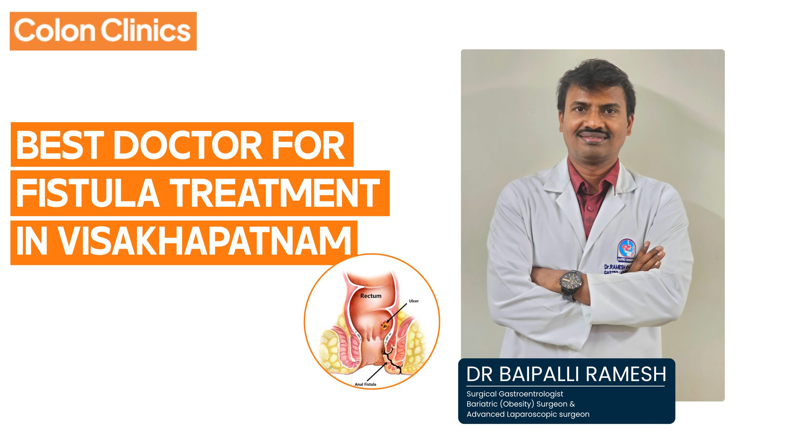 Best Doctor for Fistula Treatment in Visakhapatnam