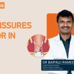 Best Fissures Doctor in Vizag