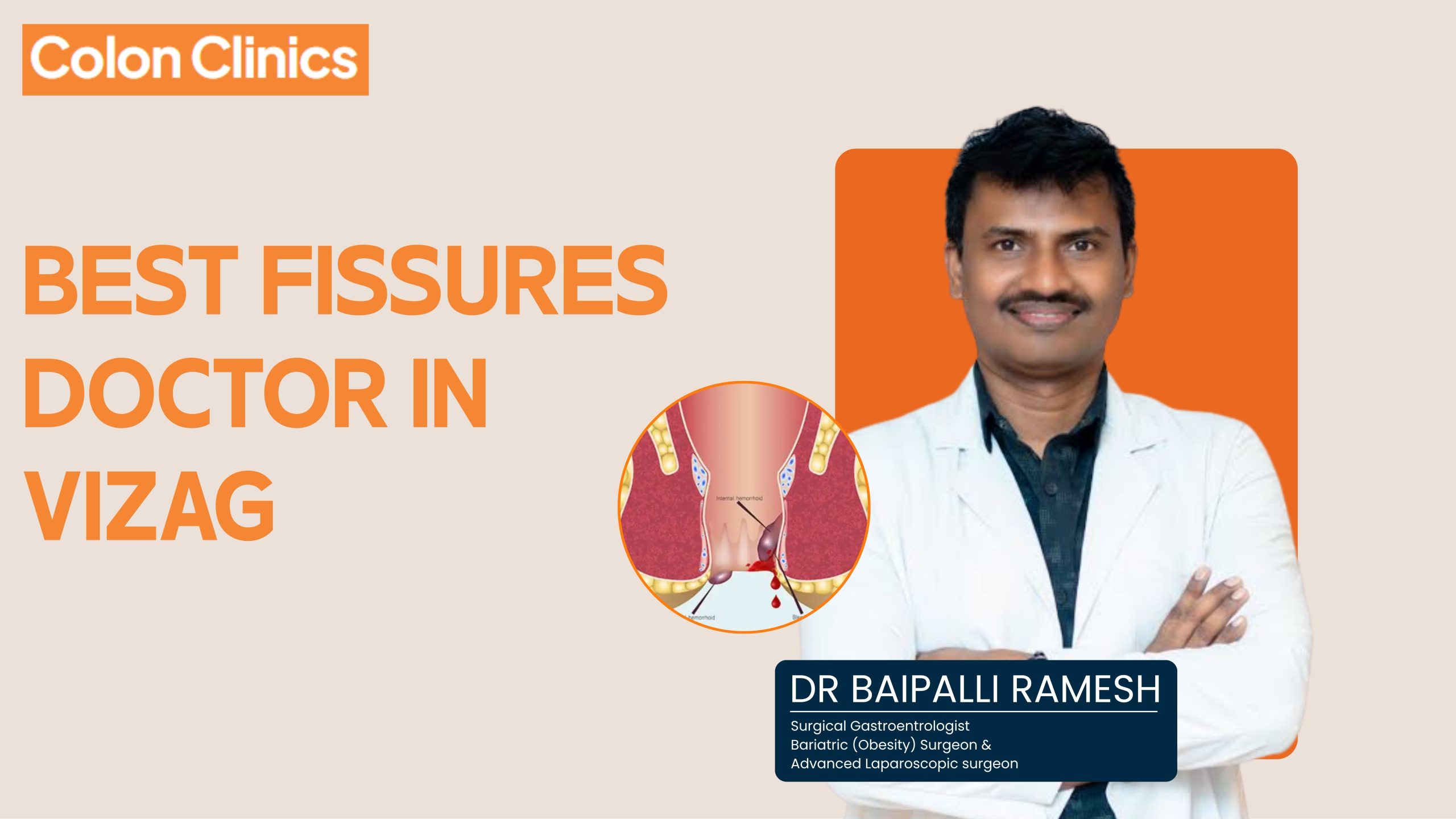 Best Fissures Doctor in Vizag